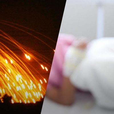 На Сумщині використали заборонені фосфорні снаряди: у лікарні дитина
